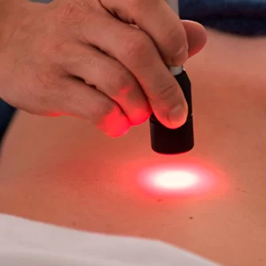 Laserterapia